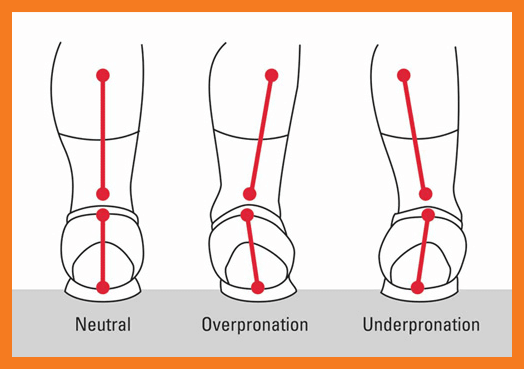 gait issue diagram